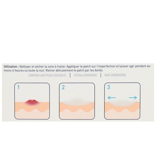 22 patchs anti-imperfections